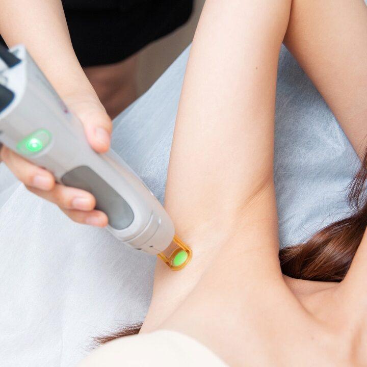 high society skin clinic laser hair removal