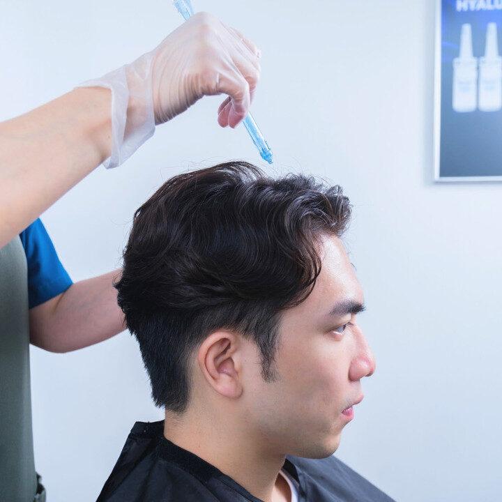 Svenson Jet And Peeling